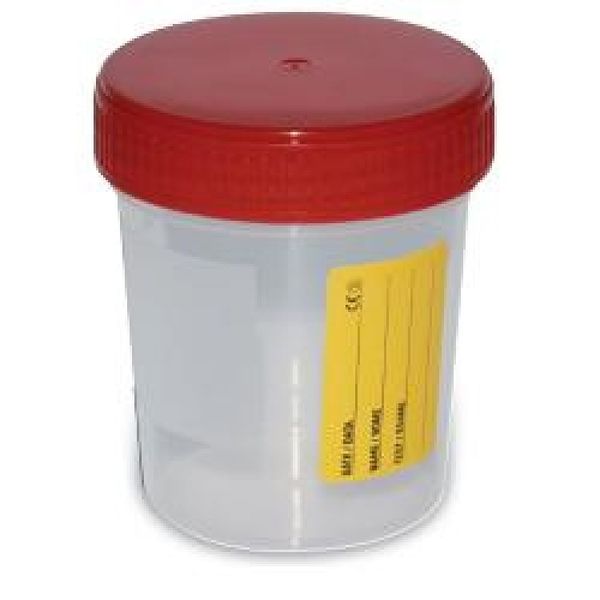 contenitore sterile urina